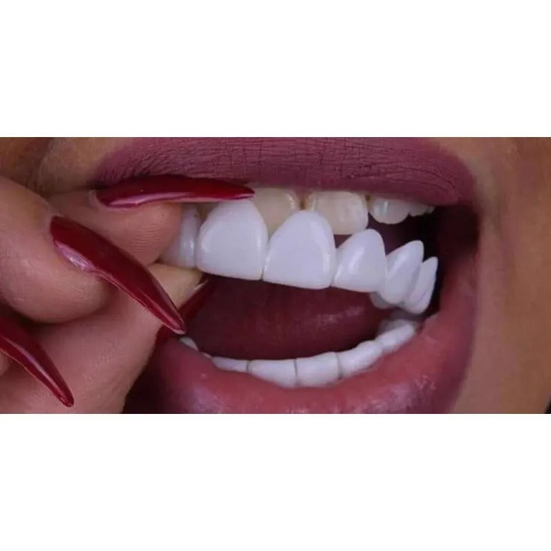 Protesis Dental Snap On Smile